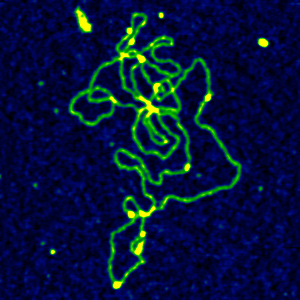 Predisposizione genetica all'obesitÃ